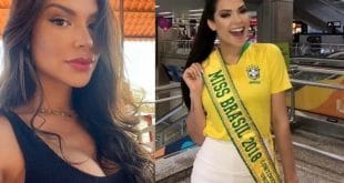 Brazil: former miss dies after undergoing surgery