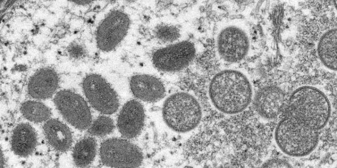 Morocco detects first case of monkeypox