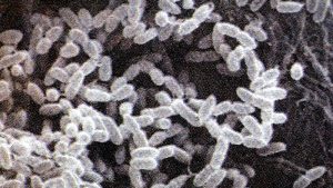 United States: bacterium causing serious infectious disease detected