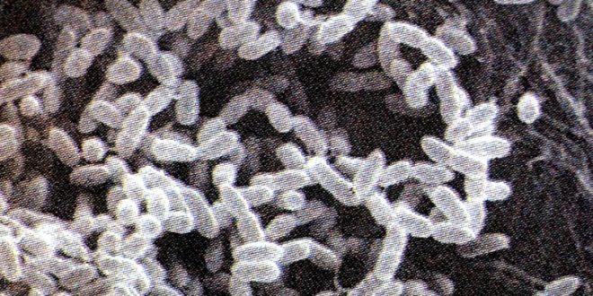 United States: bacterium causing serious infectious disease detected