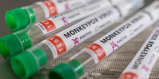 monkeypox in India