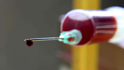 Anger as girl injects boyfriend's HIV-positive blood 'to prove love'