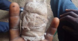 Ghana: man slashes 10-year-old boy’s finger over attempted stealing