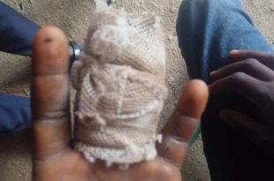 Ghana: man slashes 10-year-old boy’s finger over attempted stealing