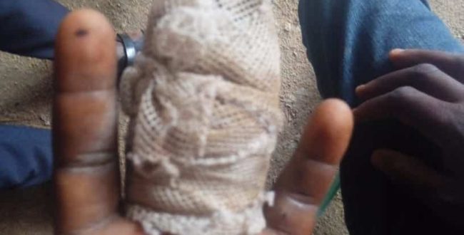 Ghana: man slashes 10-year-old boy’s finger over attempted stealing