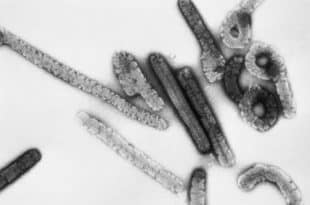 Equatorial Guinea confirms Marburg virus outbreak