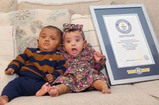 These twins hold the world's most premature twins record