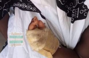 A carpenter cut off his son's two fingers