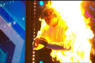 A contestant burned himself during the British Got Talent