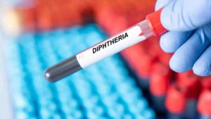 Nigeria declares deadly diphtheria outbreak in its capital