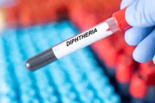 Nigeria declares deadly diphtheria outbreak in its capital