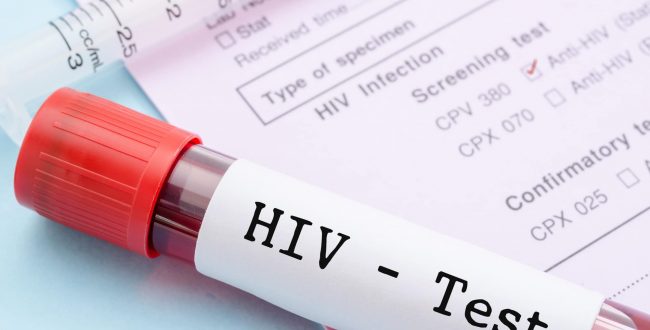 Over 100,000 unaware people are spreading HIV virus in Ghana