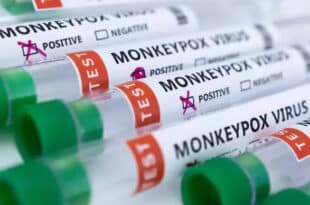 Mpox variant hits Congo displaced persons camps, children at risk
