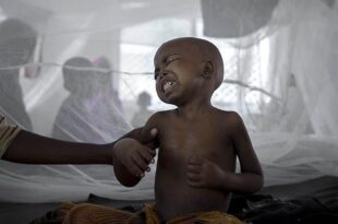 Sudan: 1,235 people die of cholera