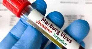 The Marburg epidemic is over in Rwanda
