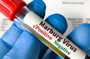The Marburg epidemic is over in Rwanda