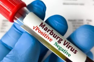 Tanzania: eight people die of Marburg virus