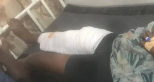 A tree falls on residents in Buduburam